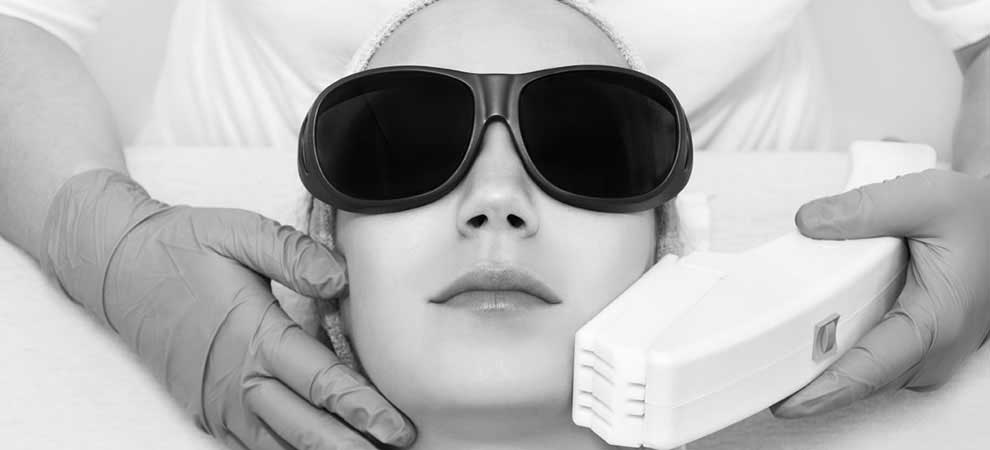 laser hair removal