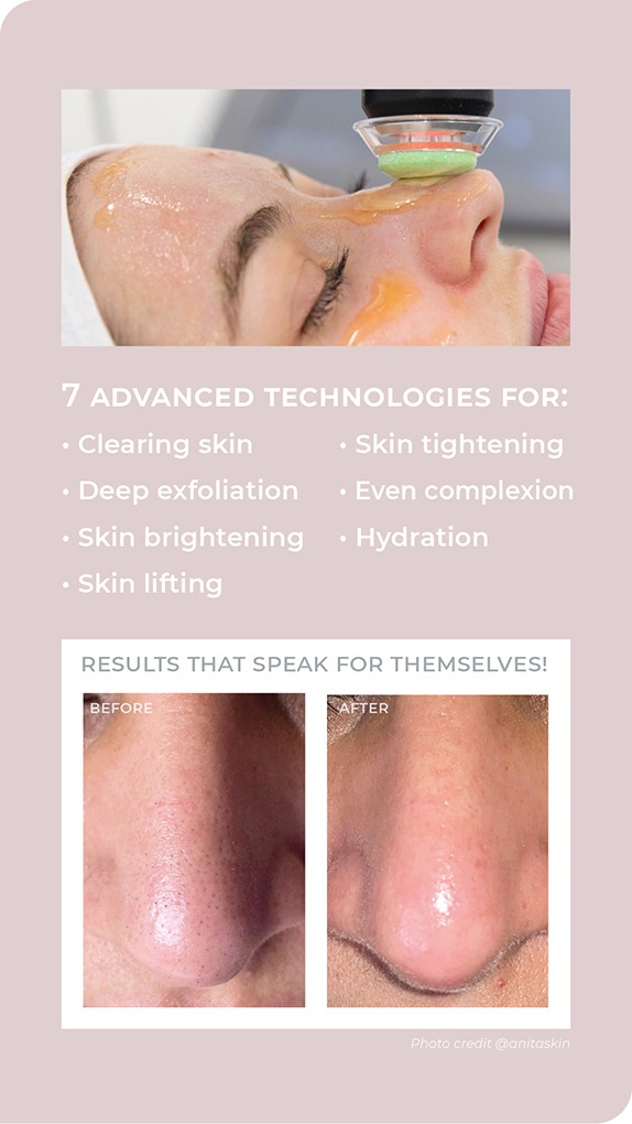 3D-Hydro2 Facial